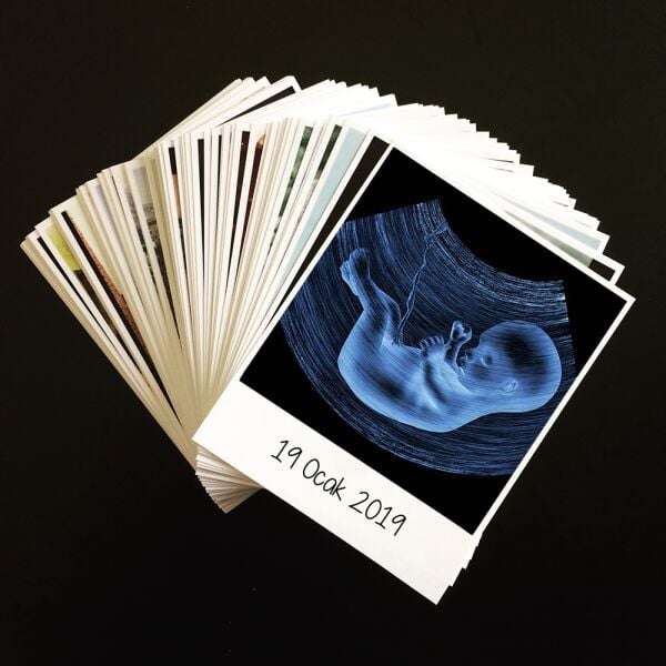 Ultrason Pola Kart - 10 Adet