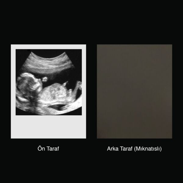 Ultrason Pola Magnet - 10 Adet