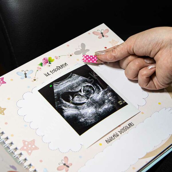 Hamilelik Ve Anne Bebek Günlüğü Pembe Anı Defteri